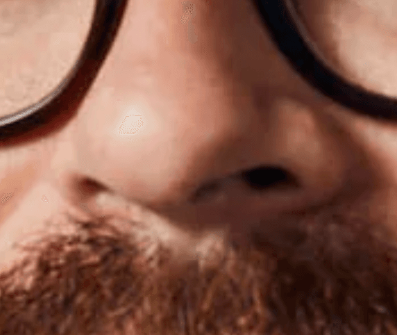 smellhole